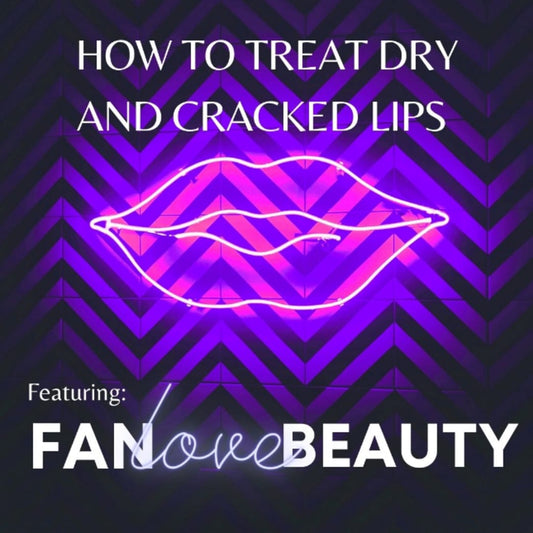 How to Treat Dry and Cracked Lips