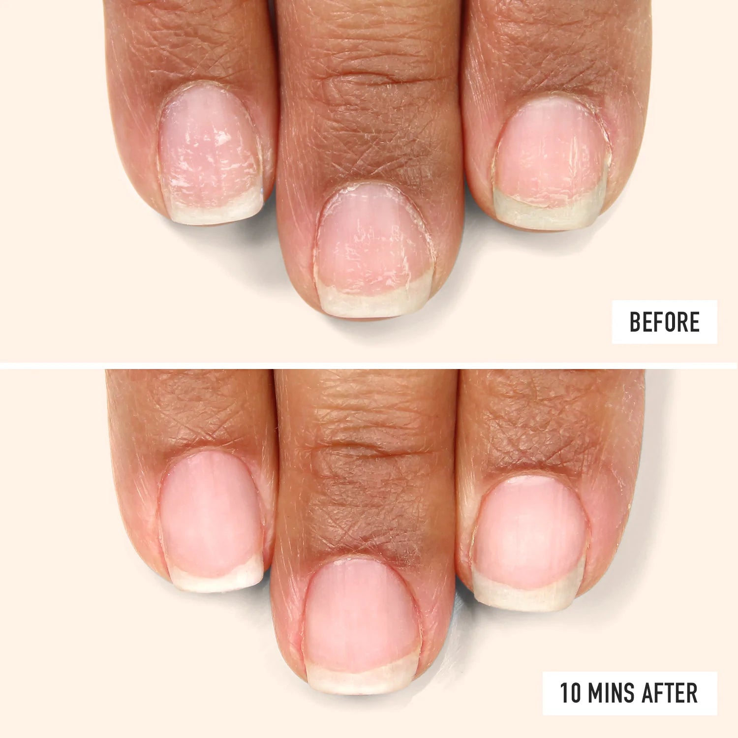 Nail Probiotic Instant Boost